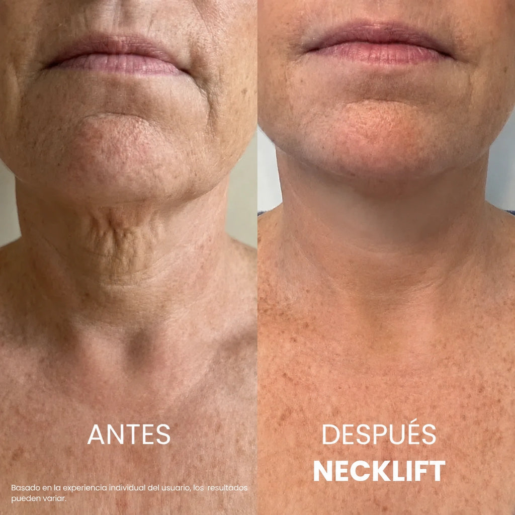 Crema para el cuello Tighten & Lift