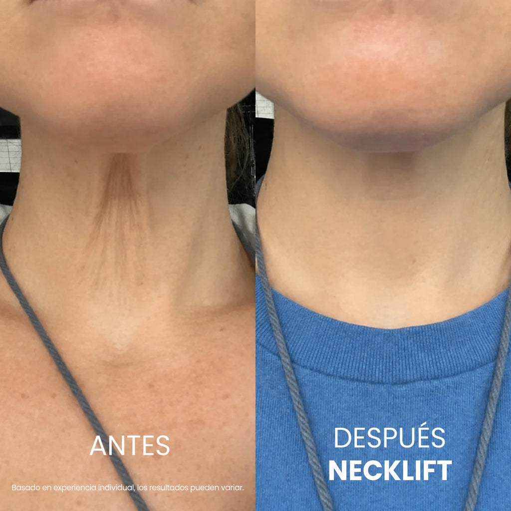 Crema para el cuello Tighten & Lift