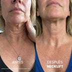 Crema para el cuello Tighten & Lift
